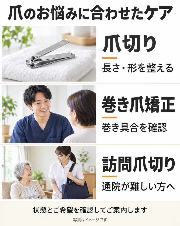 爪切り・巻き爪矯正・訪問爪切りのご案内 爪切り:巻き爪矯正、通院が難しい方への訪問爪切りの案内。