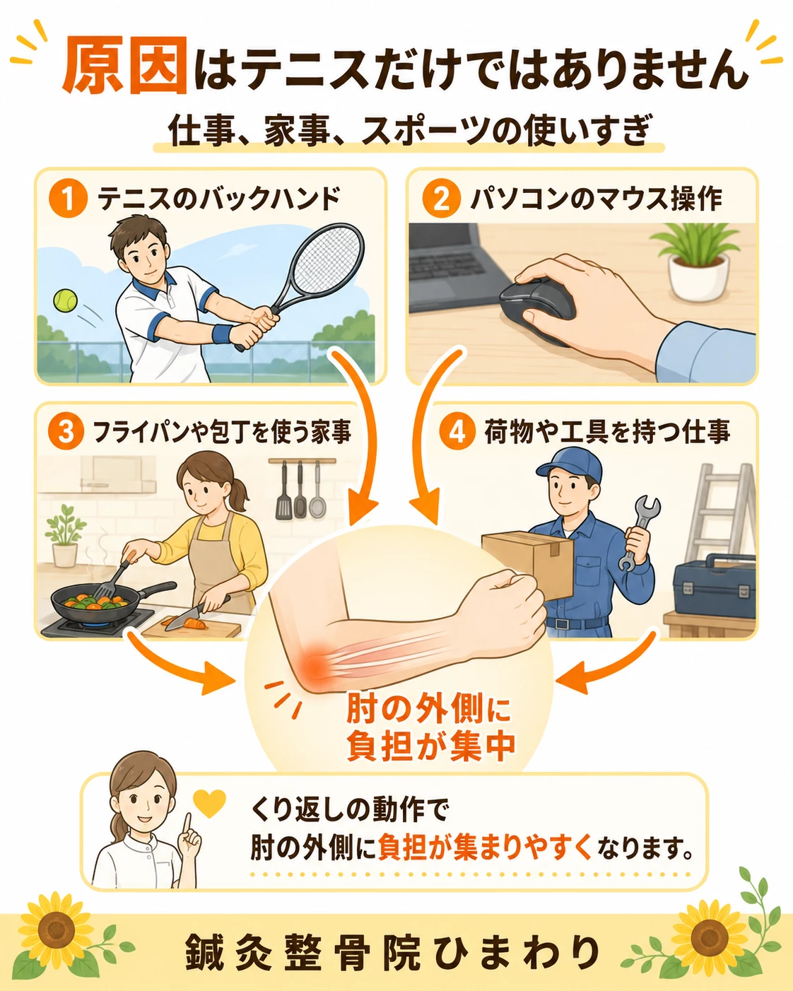 外側上顆炎、テニス肘の原因として、テニス、パソコン作業、家事、重い物を持つ仕事などの使いすぎを示した画像