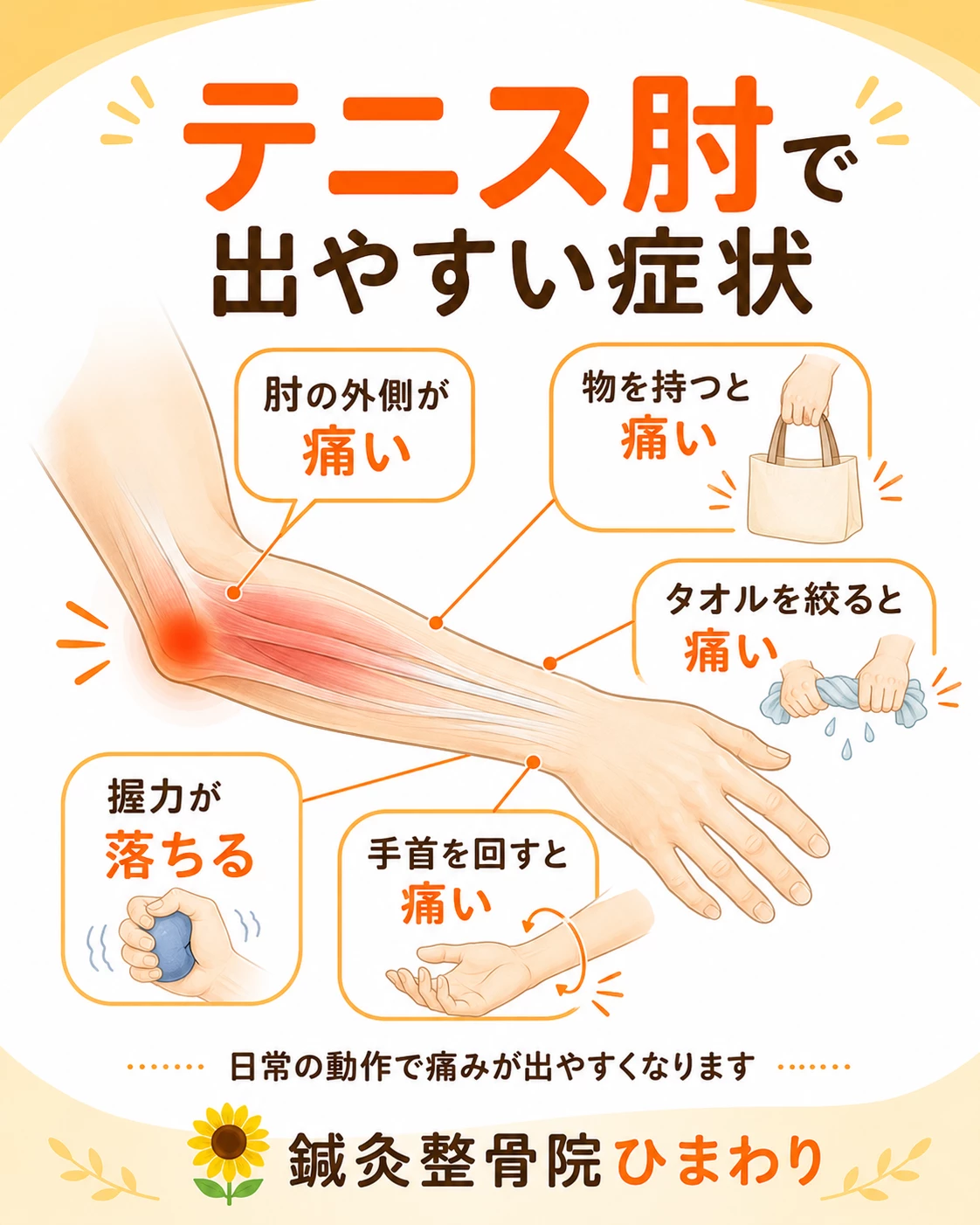 テニス肘で出やすい肘の外側の痛み、前腕の張り、物を持つ時の痛み、握力低下を示した症状マップ