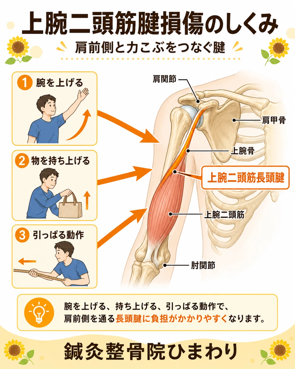 上腕二頭筋長頭腱が肩関節の前側を通り、腕の上げ下げや持ち上げ動作で負担がかかる仕組みを示した図解