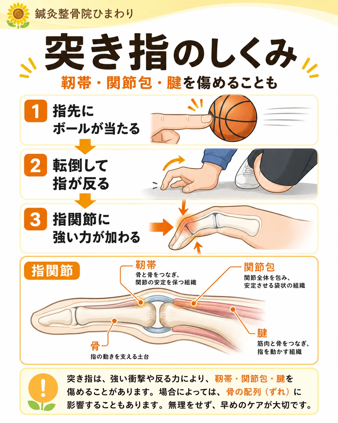 突き指で指先から強い力が加わり、指関節の靱帯、関節包、腱、骨に負担がかかる仕組みを示した図解
