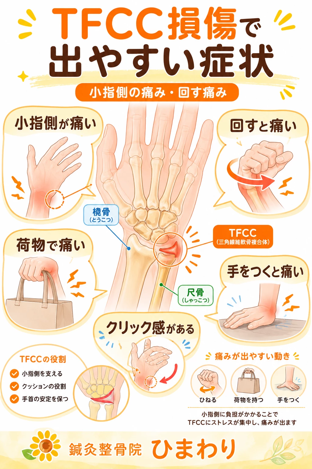 転倒して手をつく、手首をひねる、テニスやゴルフのインパクト、荷物を持つ動作でTFCCに負担がかかることを示した画像