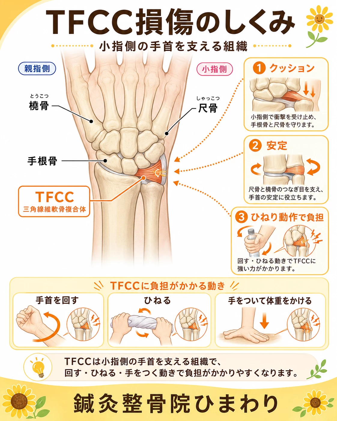 TFCC損傷で出やすい手首の小指側の痛み、手首を回す時の痛み、荷物を持つ時の痛み、クリック感や力の入りにくさを示した画像