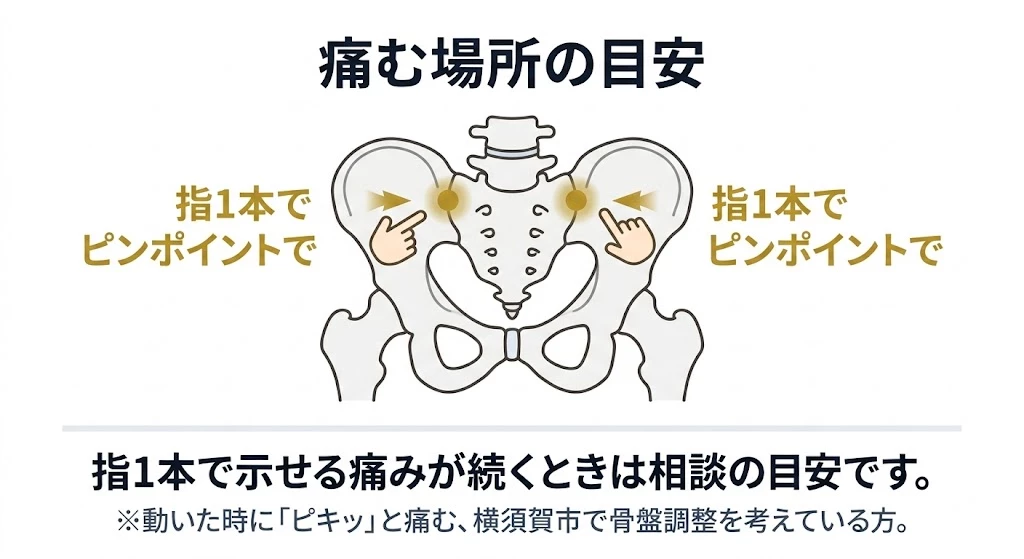 横須賀市の仙腸関節痛、痛む場所の目安として骨盤の出っ張り付近を指1本で示すイラスト