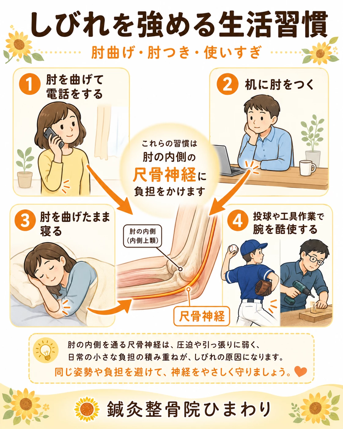 肘を長く曲げる姿勢、机に肘をつく癖、腕の使いすぎによって尺骨神経に負担がかかることを示した画像