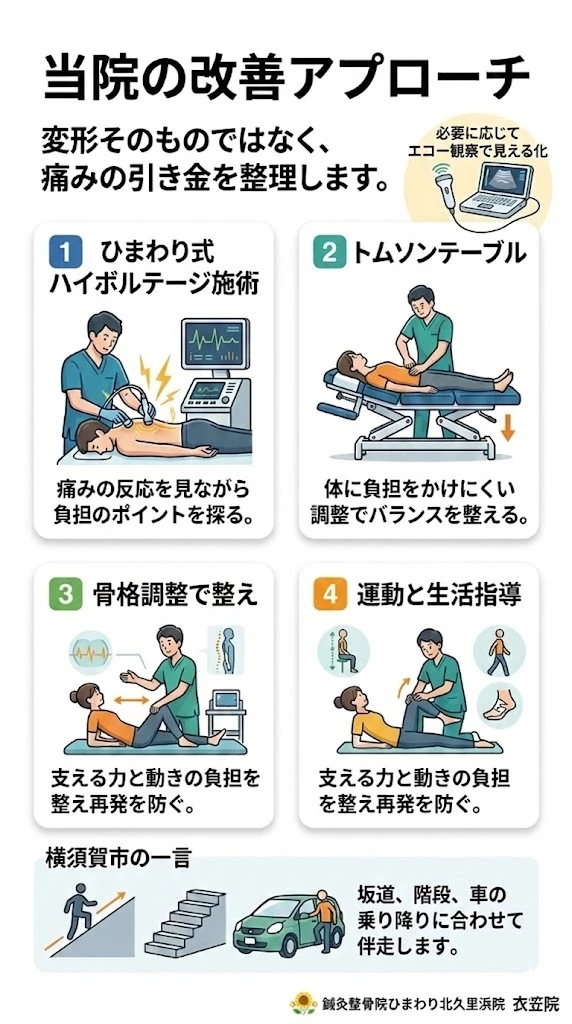 ひまわり式ハイボルテージ施術とトムソンテーブルと運動生活指導で進める変形性腰椎症の改善アプローチ