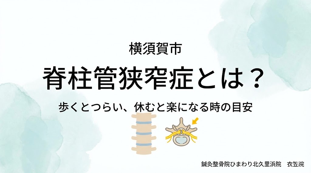 横須賀市で脊柱管狭窄症の特徴と受診目安を解説する鍼灸整骨院ひまわり北久里浜院、衣笠院のアイキャッチ画像