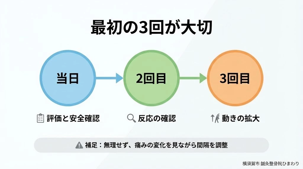 ぎっくり腰 初期3回の通院目安と間隔を示すタイムライン