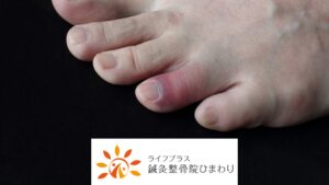 横須賀市，指の捻挫，整骨院
