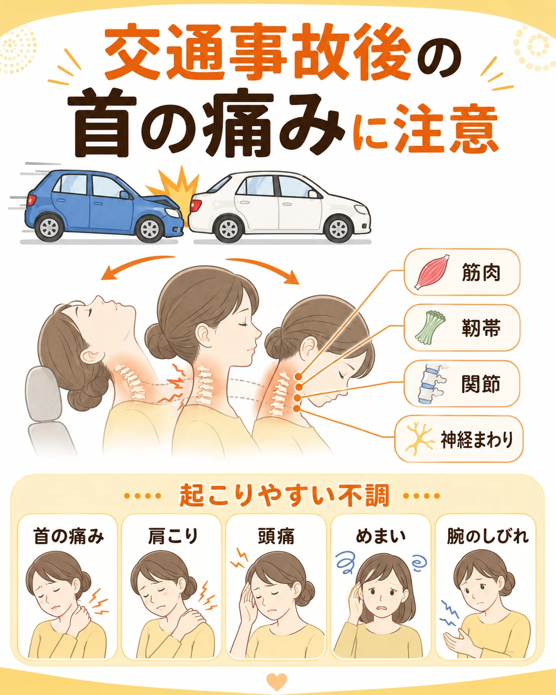 交通事故の衝撃で首が前後に揺さぶられむちうち症が起こる仕組みを説明する図解画像
