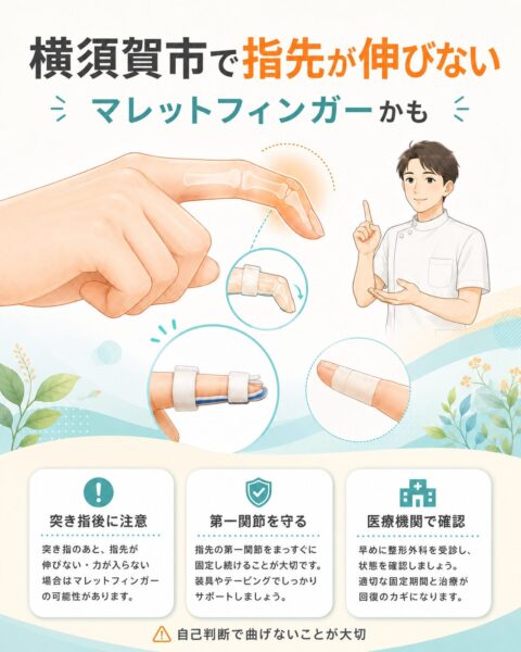 横須賀市でマレットフィンガーによる指先が伸びない症状を相談する方へ向けたアイキャッチ画像