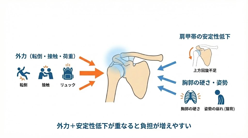 横須賀市の肩鎖関節損傷　転倒や接触や荷重などの外力と肩甲帯の安定性低下が重なり肩鎖関節に負担が増える仕組みの図解