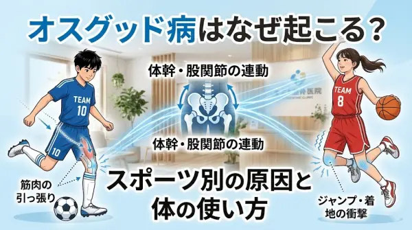 横須賀市でオスグッドの原因とスポーツ別の体の使い方を解説する記事のアイキャッチ画像