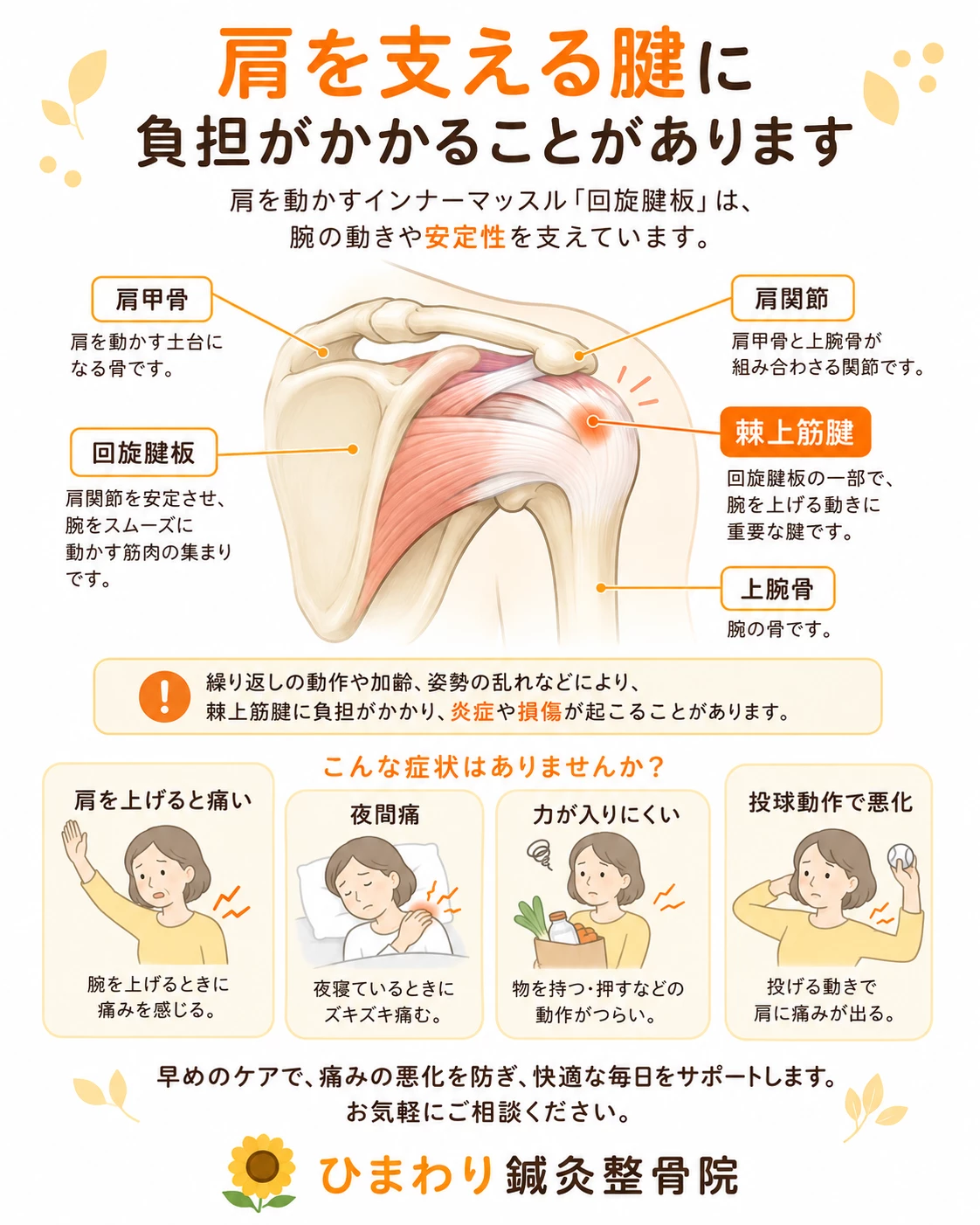回旋腱板損傷とは 回旋腱板損傷で肩を支える腱に炎症や損傷が起こり肩の痛みや夜間痛が出る仕組みを説明する画像