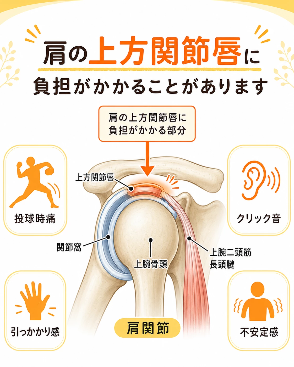 SLAP損傷で肩関節の上方関節唇や上腕二頭筋長頭腱付着部に負担がかかり投球時痛やクリック音が出る仕組みを説明する図解画像