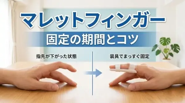 横須賀市でマレットフィンガーの固定期間と装具管理のコツを解説する鍼灸整骨院ひまわりのアイキャッチ画像