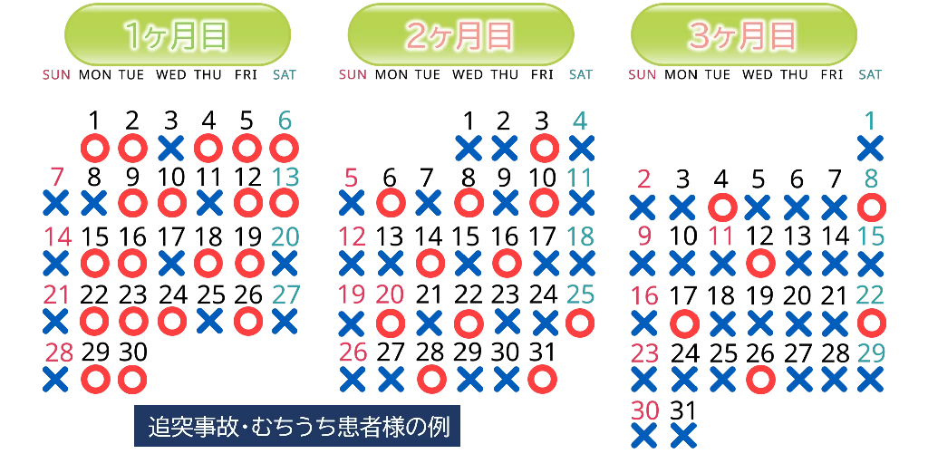 交通事故後の通院期間の目安を初期から回復期まで三つの段階で示したタイムライン図