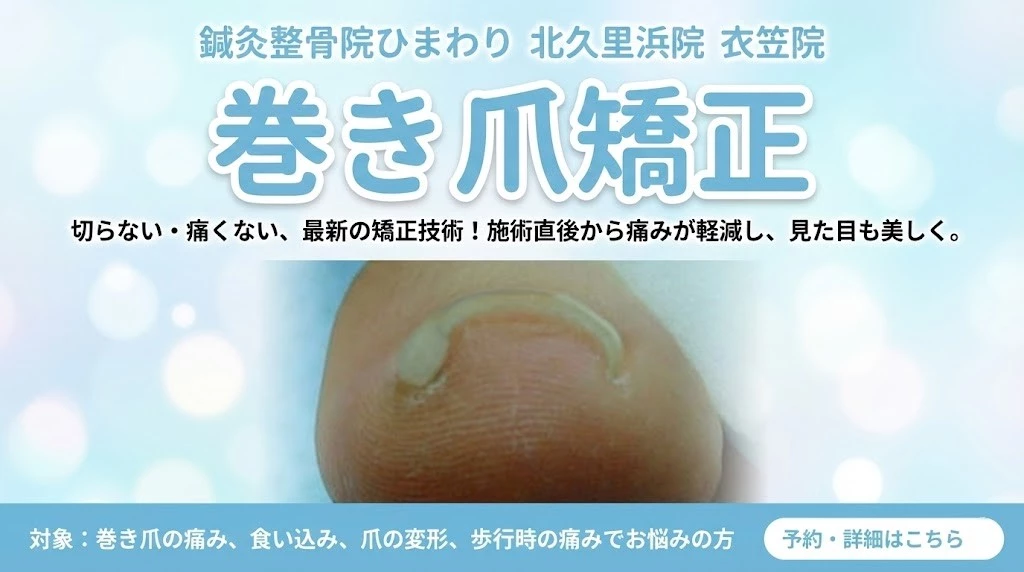 横須賀市の鍼灸整骨院ひまわり北久里浜院と衣笠院の巻き爪矯正バナー。巻き爪の見た目と相談案内。