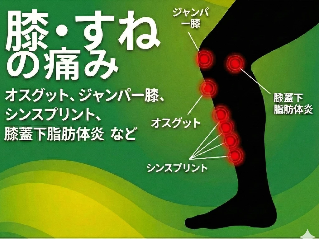 膝やすねの痛みとオスグットジャンパー膝シンスプリント膝蓋下脂肪体炎などを示すスポーツ障害イラスト