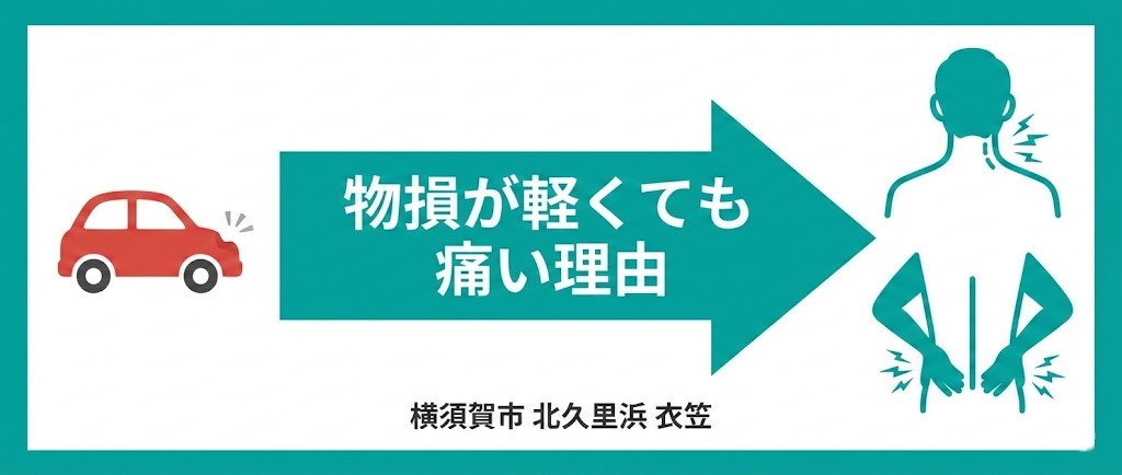 横須賀市の交通事故で物損が軽く見えても首や腰が痛い理由を解説、北久里浜、衣笠
