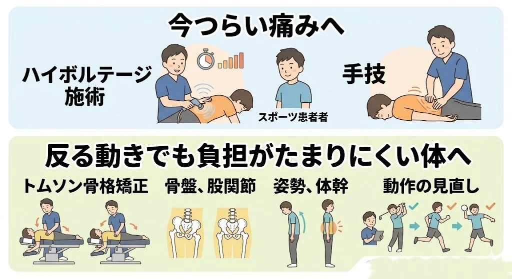 反ると痛いスポーツ腰痛に対する施術と再発予防の流れを表した画像