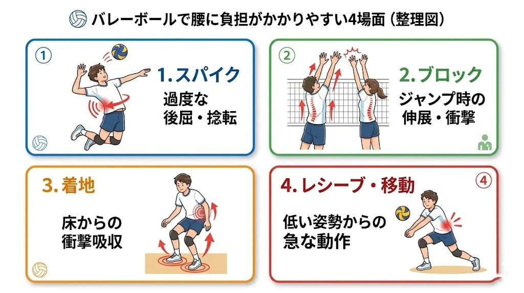 バレーボールのスパイク、ブロック、着地、レシーブで腰に負担がかかる場面