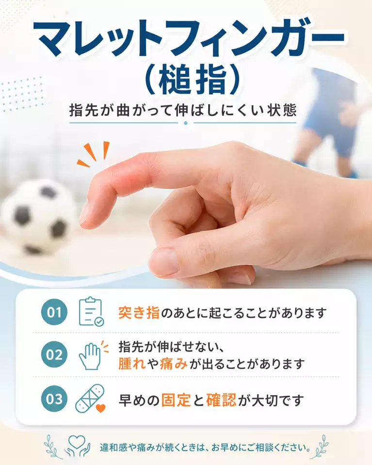 横須賀市でマレットフィンガーによる指先が曲がって伸ばしにくい状態、突き指後の腫れや痛み、早めの固定と確認の大切さを解説する画像