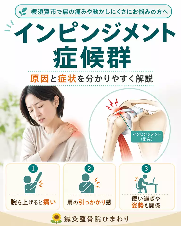 横須賀市でインピンジメント症候群による肩の痛みや動かしにくさ、腕を上げると痛い、肩の引っかかり感、使い過ぎや姿勢との関係を解説する画像 横須賀市でインピンジメント症候群による肩の痛みや動かしにくさ、腕を上げると痛い、肩の引っかかり感、使い過ぎや姿勢との関係を解説する画像