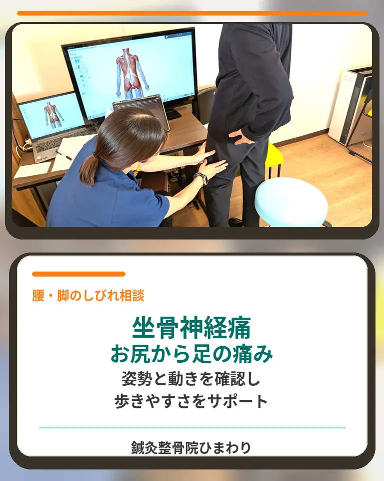 横須賀市で坐骨神経痛によるお尻から足の痛みやしびれを相談できる鍼灸整骨院ひまわりの案内画像