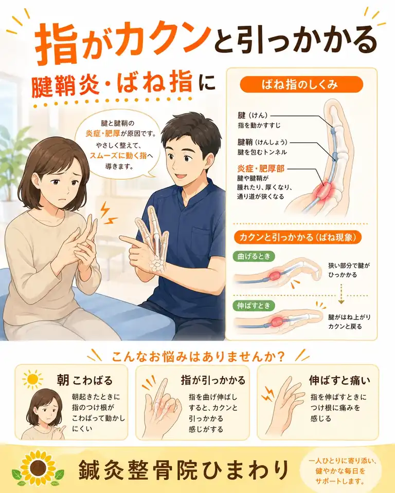 横須賀市で腱鞘炎、ばね指の指の引っかかりを相談 横須賀市で腱鞘炎、ばね指による指の引っかかりにお悩みの方へ